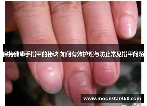 保持健康手指甲的秘诀 如何有效护理与防止常见指甲问题